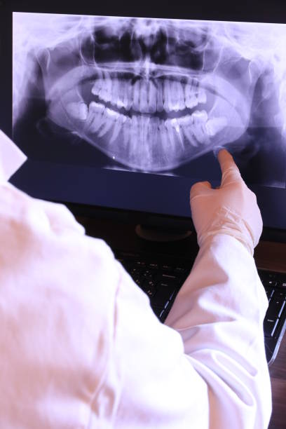 Best Emergency Gum Treatment in Adel, IA