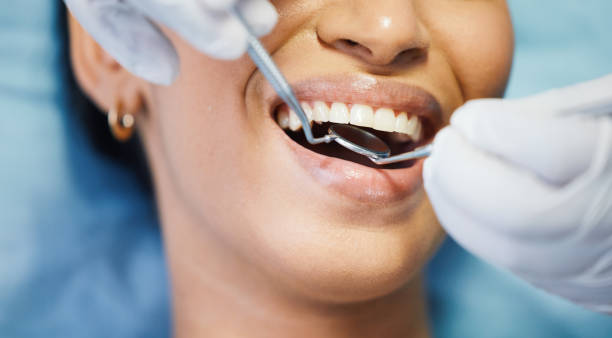 Best Emergency Treatment for Dental Infections or Abscesses in Adel, IA